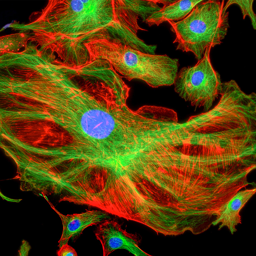 Fluorescently stained cells